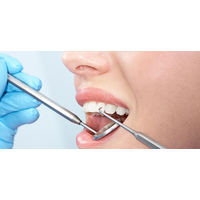 Dantų protezavimas kaina – internetinėje erdvėje dažnai ieškomi žodžiai